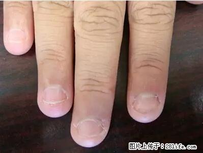 剪指甲、挖耳屎，这些日常小动作竟隐藏大危害！ - 阜阳生活资讯 - 阜阳28生活网 fy.28life.net